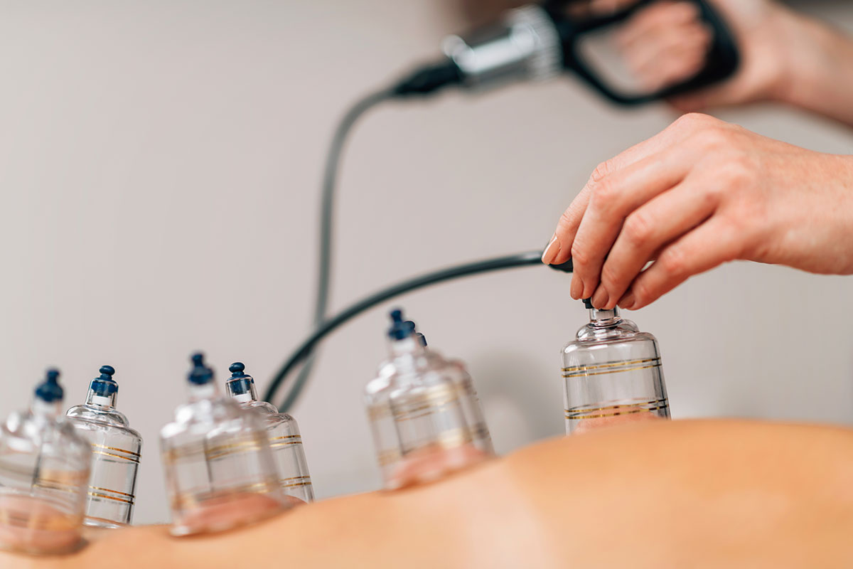 Cupping massage met 8 cups